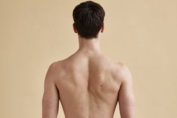 Upper Back vaser lipo