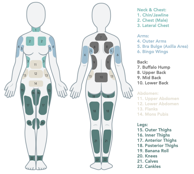 Liposhape Areas Updated